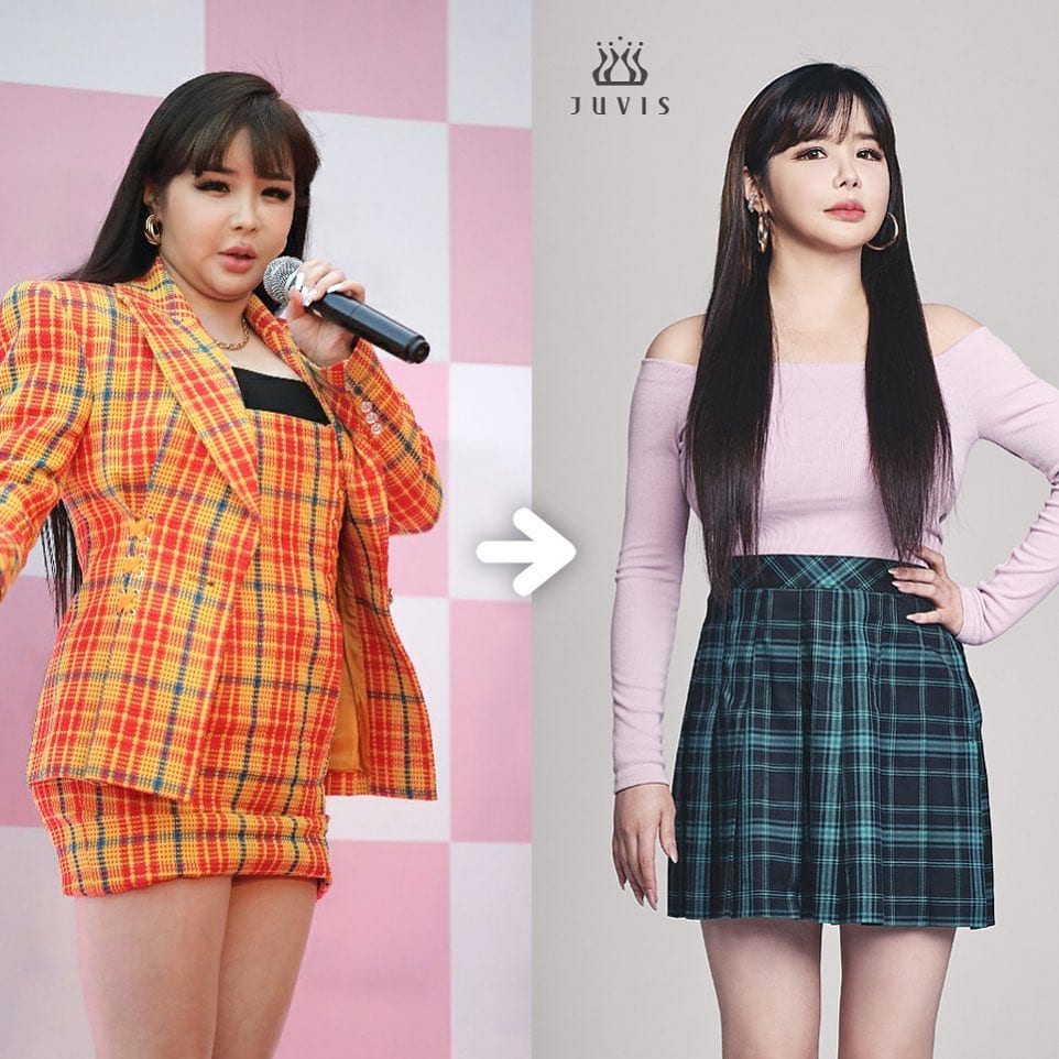 Park Bom Has Lost 24 Pounds  Her Before and After Picture Shocks Netizens - 12