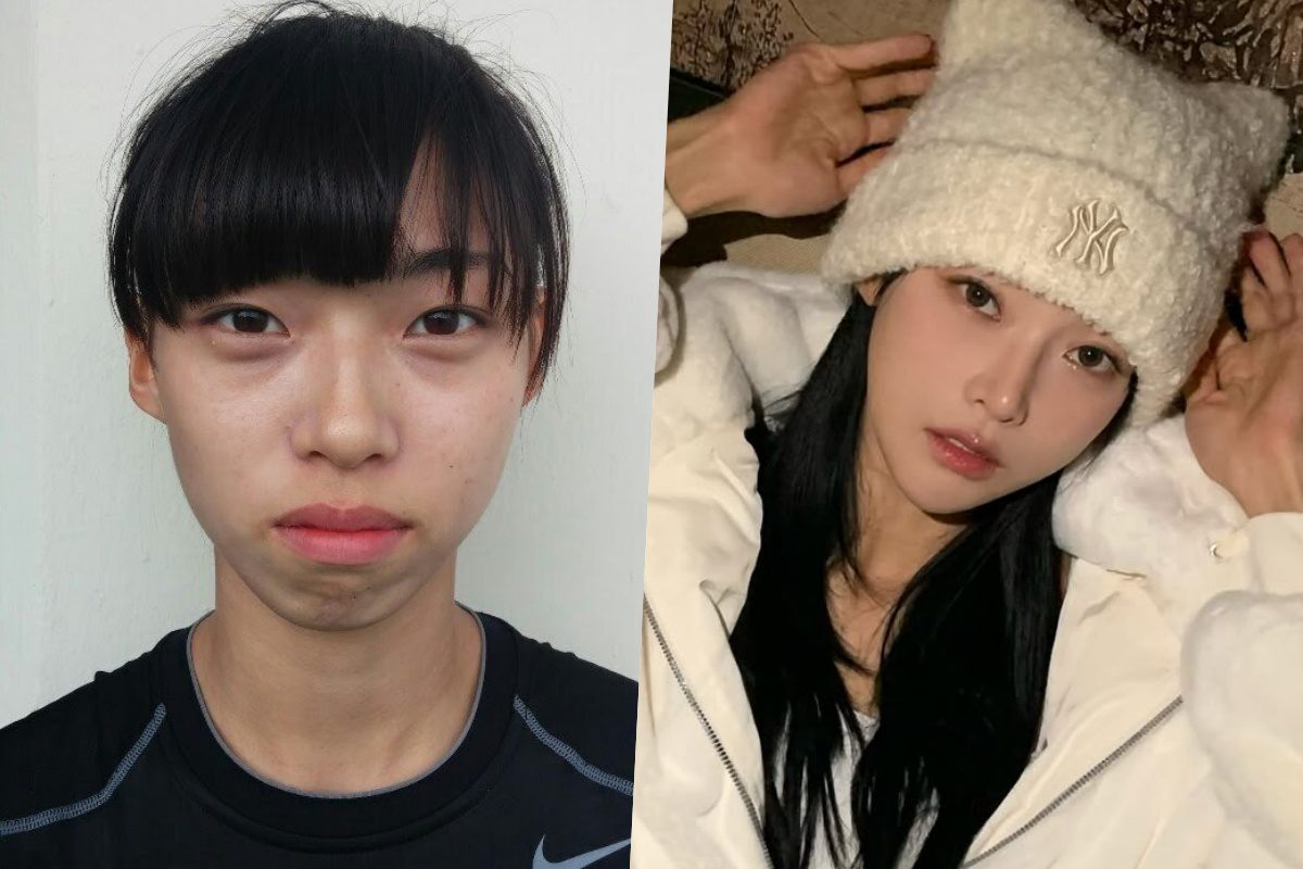 kim min ji plastic surgery rumors