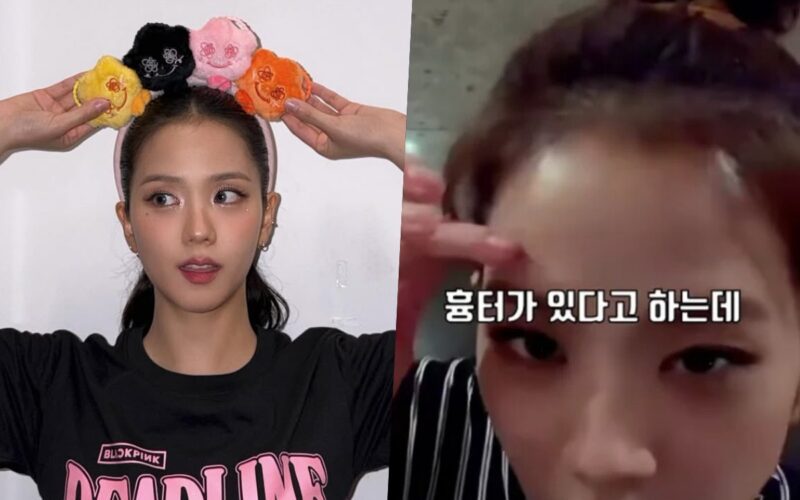 blackpink jisoo scar