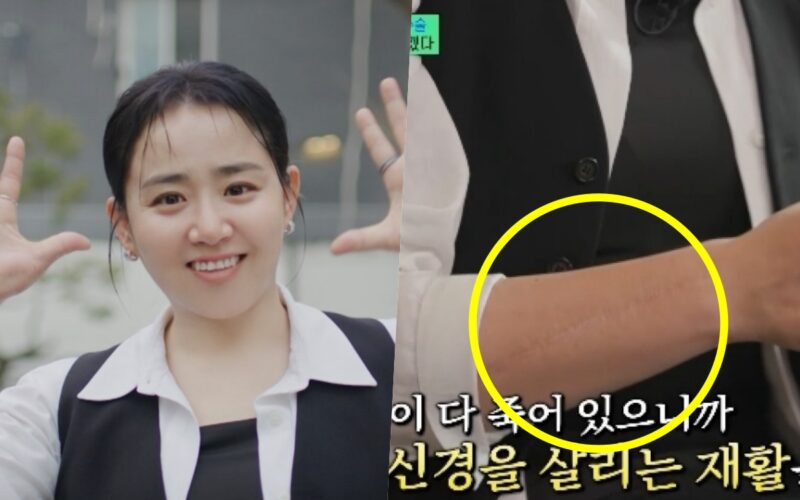 moon geun young surgery scar