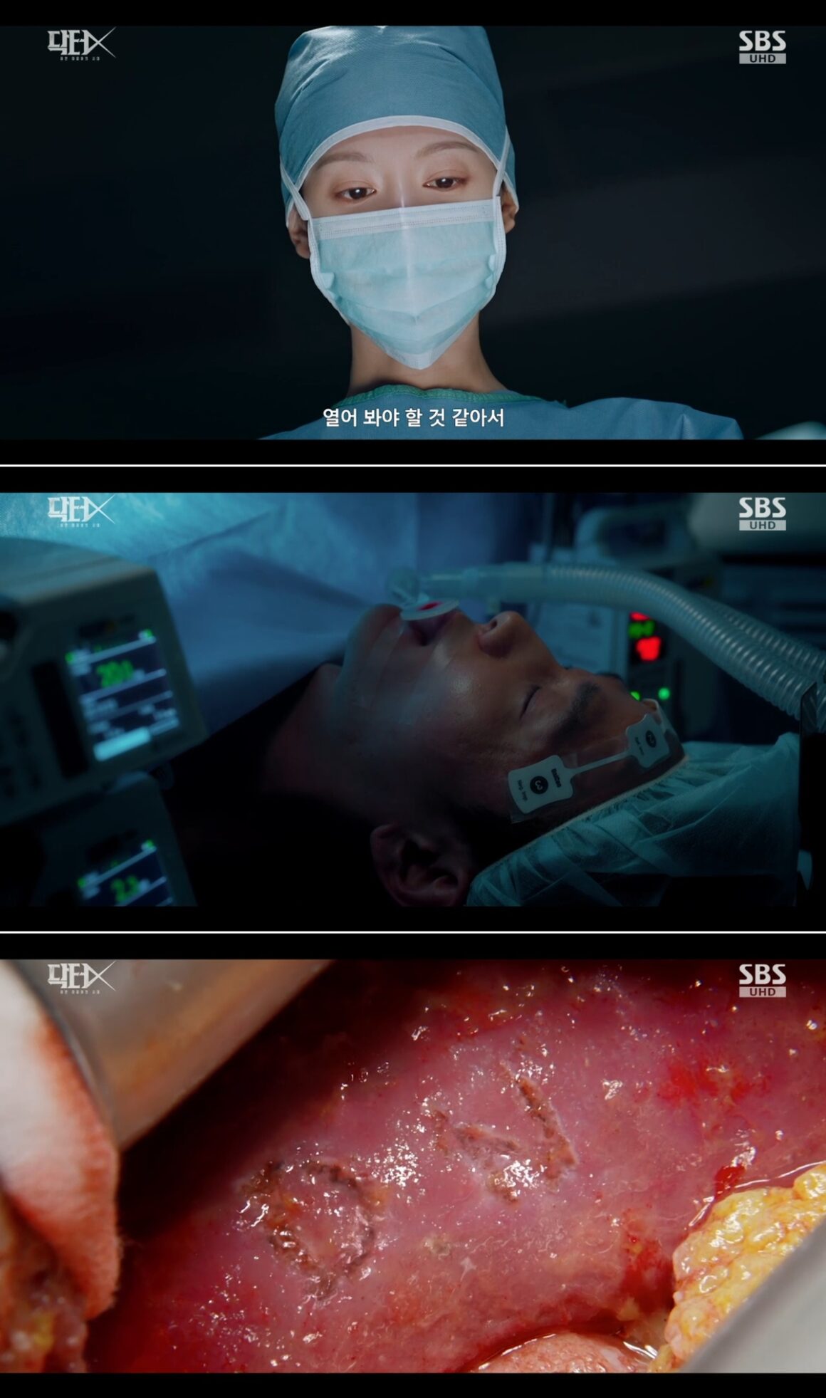'Doctor X' Shows Surgeon Carving Initials Into Patient's Liver, And It ...