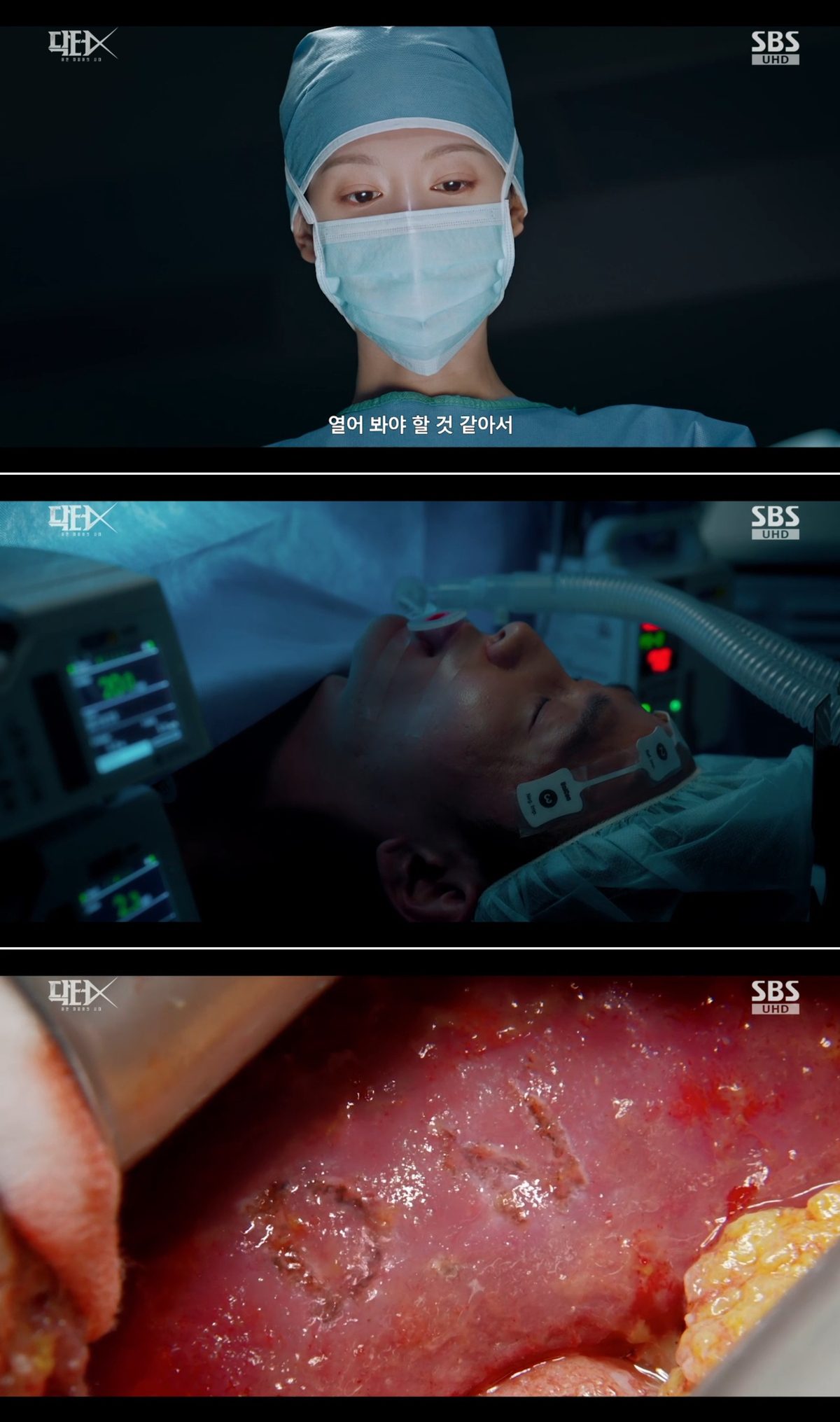 doctor x true story